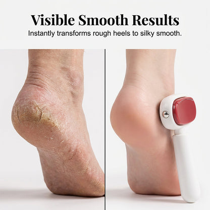 🎁50%OFF &😍 Hot sale Double-Sided Foot Scraper for Callus Removal